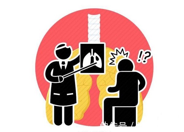 并发症|医生:肺癌手术不可怕,真正可怕的是这4种并发症,需小心护理!