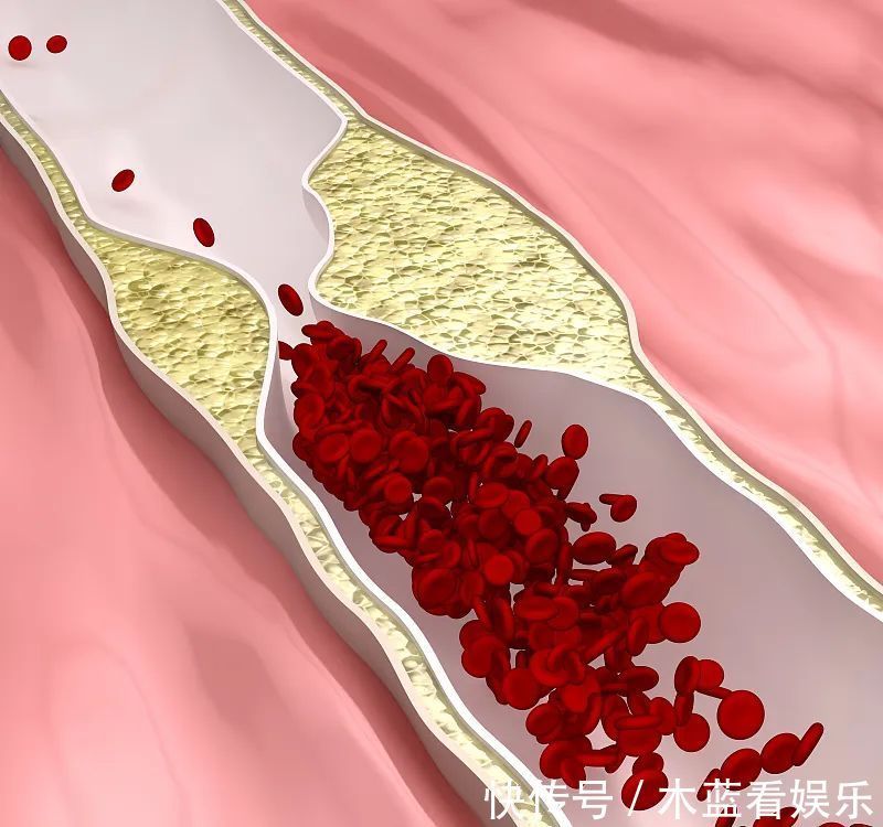 长寿|血液粘稠,常喝二水,多吃三蔬,学会三个动作,血管通畅人长寿!