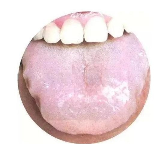 津不上承|老中医告诉你一到晚上就口干口渴的厉害是怎么回事