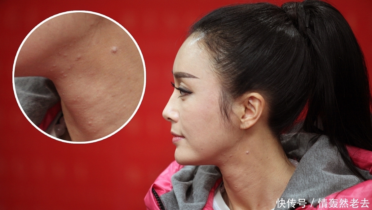 糖尿病是“拖”出来的,身体发出这3种信号,是血糖发出“警告”