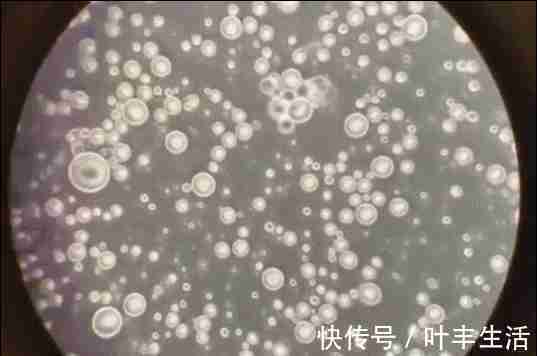 母乳喂养|为啥吃母乳的宝宝体格“倍儿棒”? 母乳具备的优点,奶粉难模仿