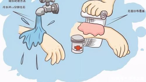 安全意识|4岁宝宝掉入170度油锅,奶奶3步救下孩子,医生:急救措施很专业