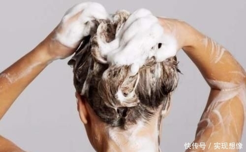 冬天头皮屑过多,是源于这4种坏习惯,若能改善头发清爽又干净