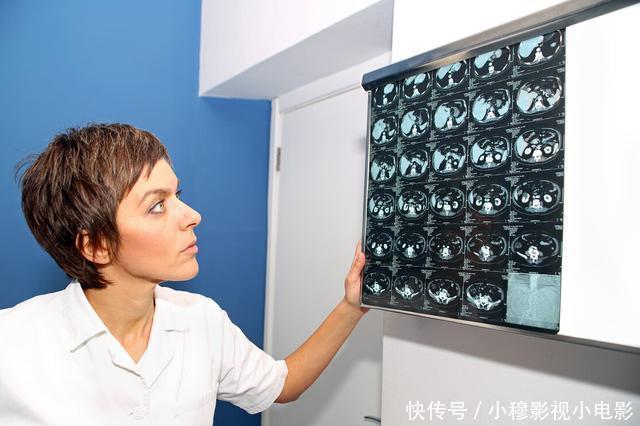 手术治疗|为什么医生总是让癌症患者做CT检查?三大作用,你可能不了解
