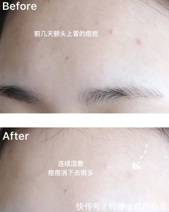 护肤品|公认“好用”的5款孕妇护肤品,全用过的是大神,孕妈:好用不贵