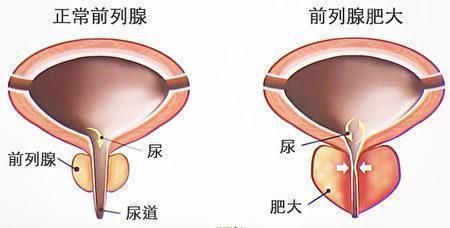 男性|早晨起床后吃一片姜，对男人有什么好处？看完你不试试吗？