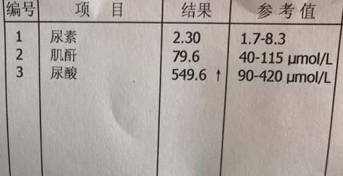  高尿酸|调理高尿酸的秘籍找到了，坚持下去，尿酸值一下降到230