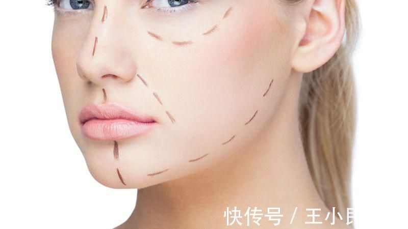 皮肤 王小民教授:小拉皮提升手术的原理是什么,效果好吗?