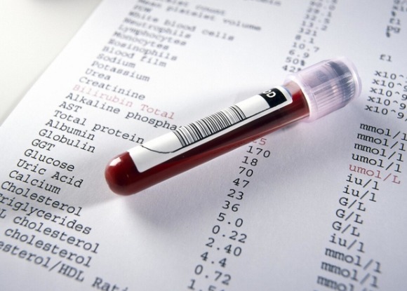 皮肤瘙痒|糖尿病为何逐年增多内分泌专家经验分享谨记3点,少往医院跑