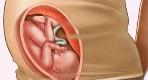 孕晚期|胎儿经常“倒立”,大头朝下不难受吗?答案与我们想的不一样