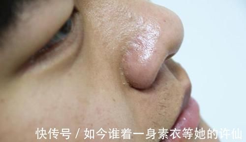 肝部|肝部变硬时,身体会出现4个“异象”,早点发现,肝脏或还有的救