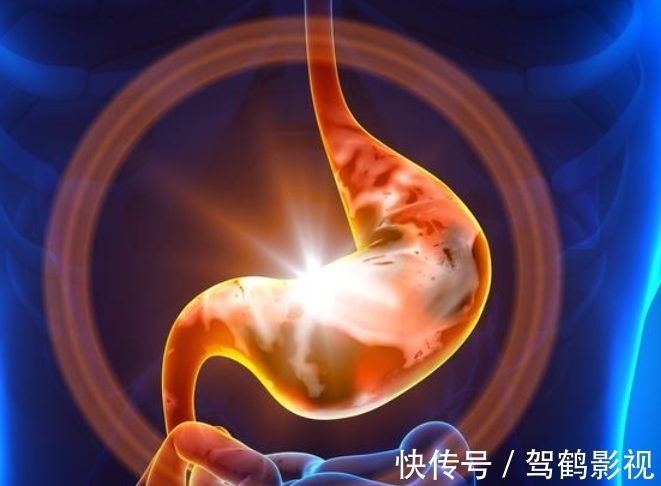 胃病|63岁张大爷幽门螺杆菌从93降至51,经验:日常坚持3件事,对胃好