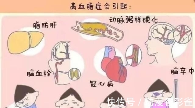 检查|多久检查一次血脂比较合适?