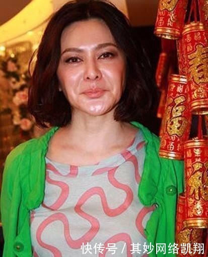 垮掉|明星都爱打玻尿酸, 但你一定没看过她们脸垮掉的样子