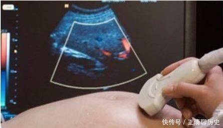 胎儿|胎儿在妈妈肚子里也会缺氧，会这样小心的“提醒”妈妈