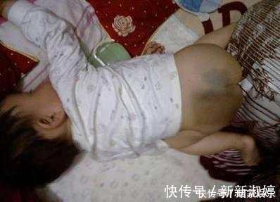 蒙古斑|为什么宝宝的屁屁都有青痕,其实屁屁上有青痕的宝宝都是有故事的