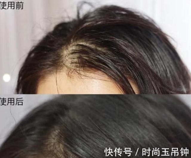 头皮|为什么理发店使用的洗发水,超市基本没有卖?说出来你可能不信