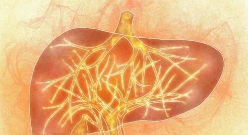 食物|肝不好别吃药，多吃5种食物，给肝脏“大扫除”，肝越来越好!