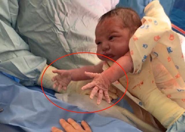小宝宝|“最社会婴儿”火了,刚出娘胎就急着和妈妈握手,网友直呼:秀儿