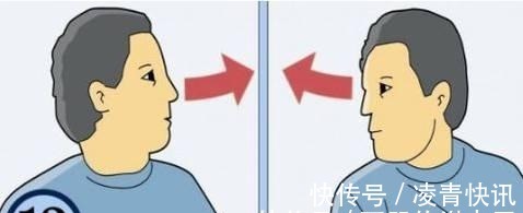 腰间盘突出|一个大误解:脖子疼就是颈椎病!经常脖子疼的人,建议好好看本文