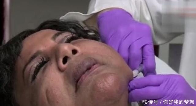 女子花2万元整容,整容失败变成“水泥脸”,看完你还想整容吗?