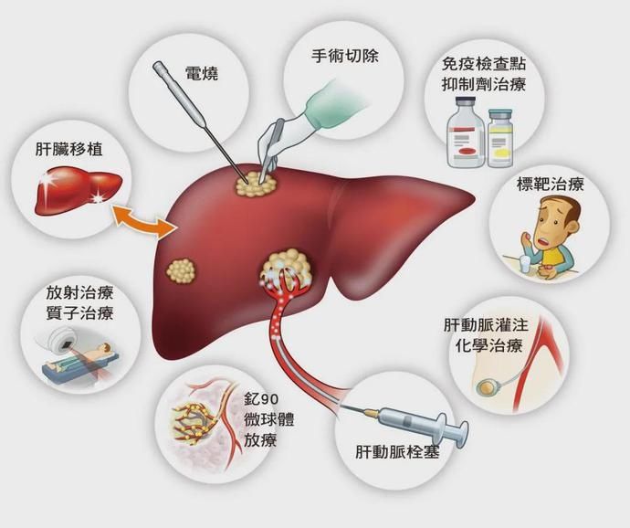 肝炎病毒|居民常见恶性肿瘤筛查和预防推荐（三）——肝癌筛查和预防推荐