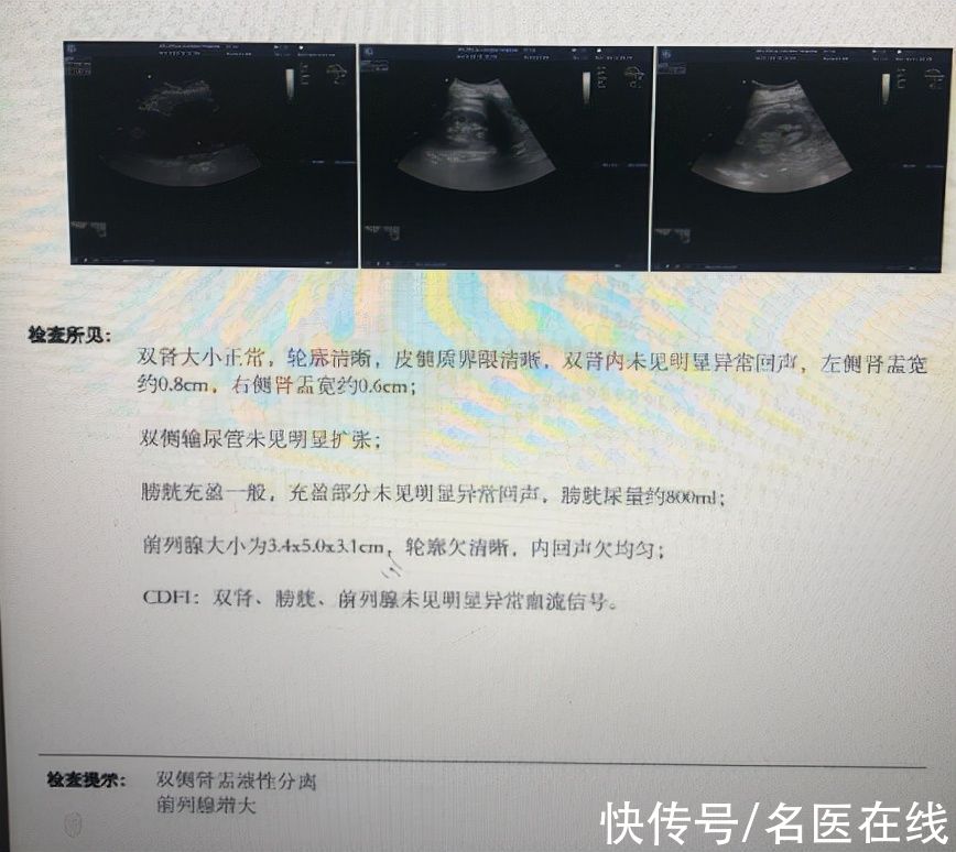 患者|有尿却尿不出，是肾出故障，还是膀胱坏了？来跟医生一起涨知识