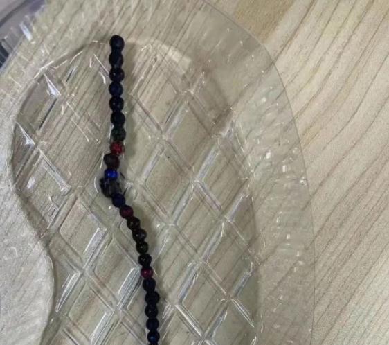 钢珠|4岁男童吞34颗钢珠,父亲:去年买的玩具,怪不得越玩越少!