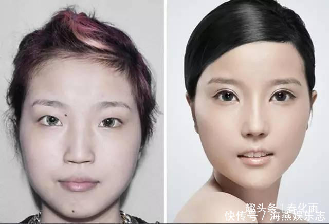 实拍：10张女孩整容前后的对比照，这真就是换了一张脸