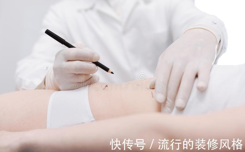 吸脂手术 女网红吸脂致死,为什么吸脂手术,没有你想象的那样美好?