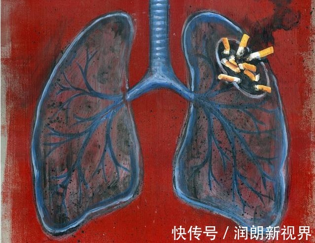 甲状腺|肺癌早期不疼不痒，身体2处持续瘙痒，说明肺受损，是时候养肺了