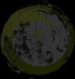 头颈部恶性肿瘤，怎样免除“切骨之痛”？|瑞金医术 | 切除