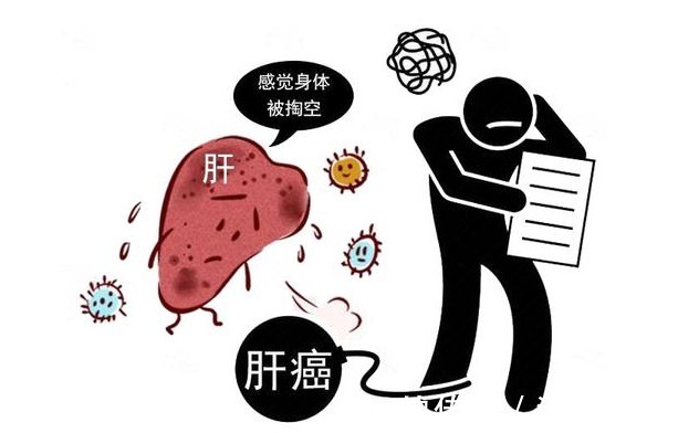 患者|肝癌发出的第一个信号，很多人以为小病，3类人最好做CT排查一下