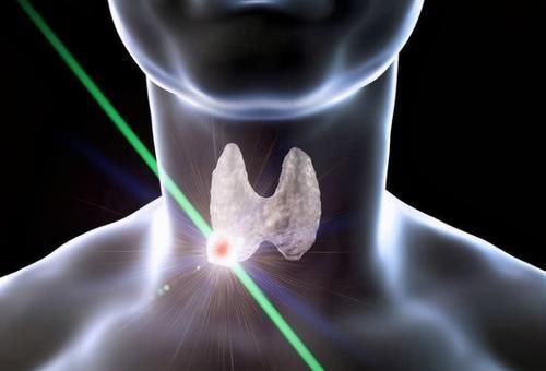 甲状腺|甲状腺有结节的人，“发物”名单已公布，榜上的食物要少碰了