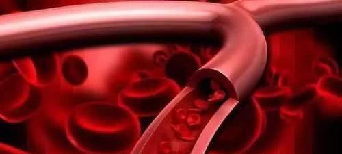 dh高血脂别急着吃药，常吃这6种食物，血脂慢慢就会降下来！