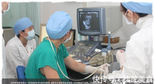 医生|那个被判了“死刑”的孩子,经过她的努力来到了人间