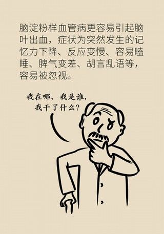 瞌睡|记性变差容易瞌睡，有可能是这种脑出血