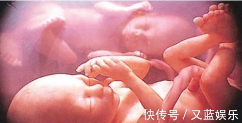 顺产|孕妇顺产双胞胎后大喊:肚子还在动,医生检查发现惊喜