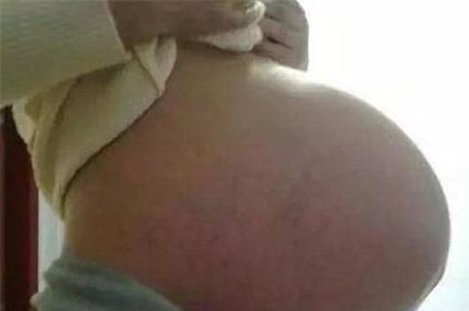 胎儿|孕肚上怀和下怀有什么区别,跟胎儿的性别有关吗?真相在这里