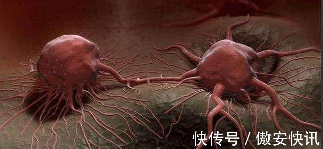 过度肥胖|癌细胞“最怕”5件事!到了45岁,若能坚持做到,长寿或与你有缘