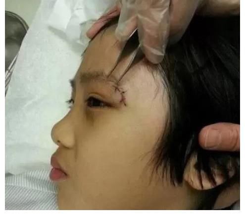 兒子錄節(jié)目留下永久性傷疤,吳鎮(zhèn)宇手撕芒果臺,討要說法終無果