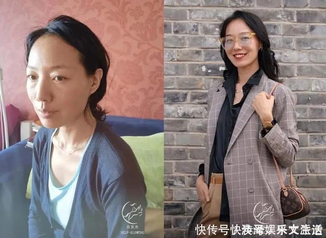 初恋这件小事|女明星注射面部逐渐“馒化”,要不要去整容?先问问她们再说吧!