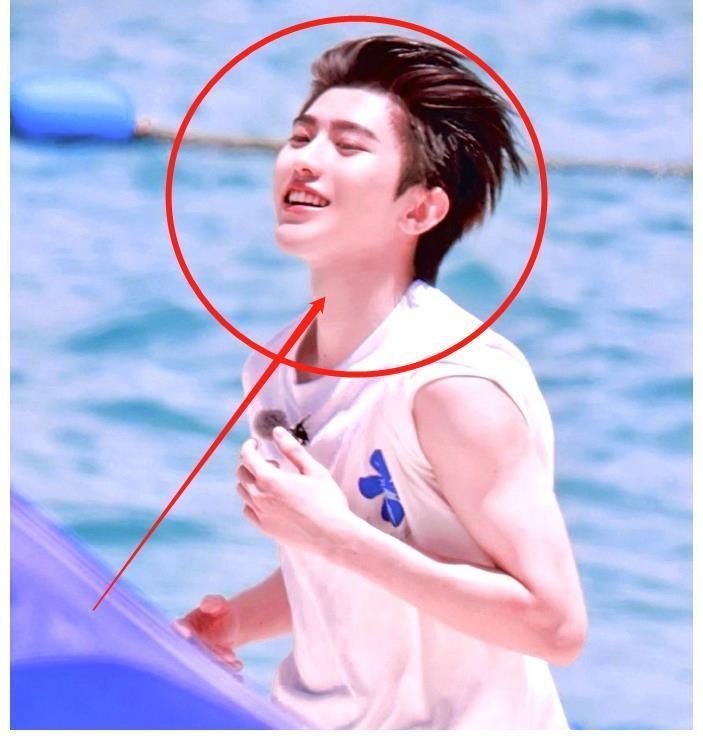 蔡徐坤参加跑男,大夏天穿羽绒服引关注,手臂上的红疹却让人心疼