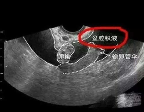 乳房|体检查出一身病?其实以下几种病不治也没事,大多数人还不了解