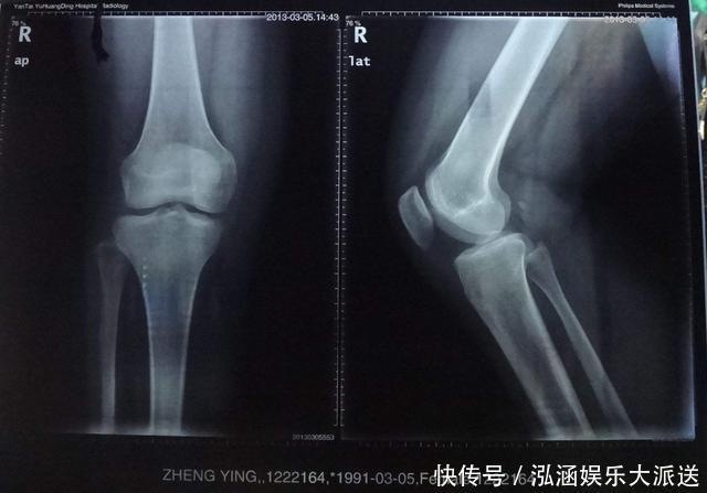 男孩多少岁停止长高？在这个年龄之前，家长得抓紧给孩子补补