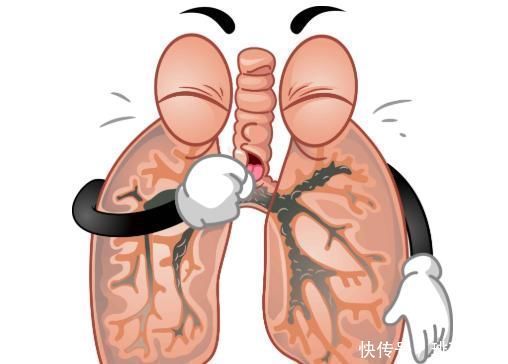 肺癌不痛不痒早期手上这些病症,已经多次提醒你