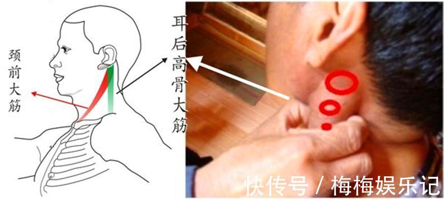 头晕|脖子上有一条大筋,捏一捏,至少可调37种疾病!不可不知!