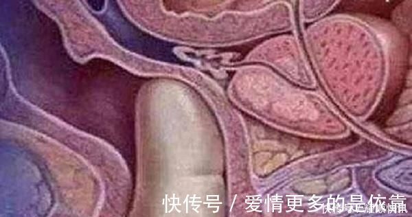 检查|产前内检很尴尬,这项检查能取消吗听听医生怎么说