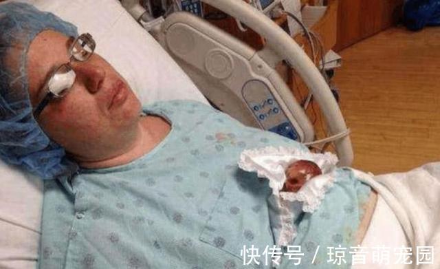 体重|在娘胎里只呆了22周的宝宝,出生时体重仅为245克,世界最小婴儿
