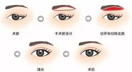 眼周状态出卖了你的年龄!